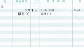 新型コロナワクチン抗体検査結果